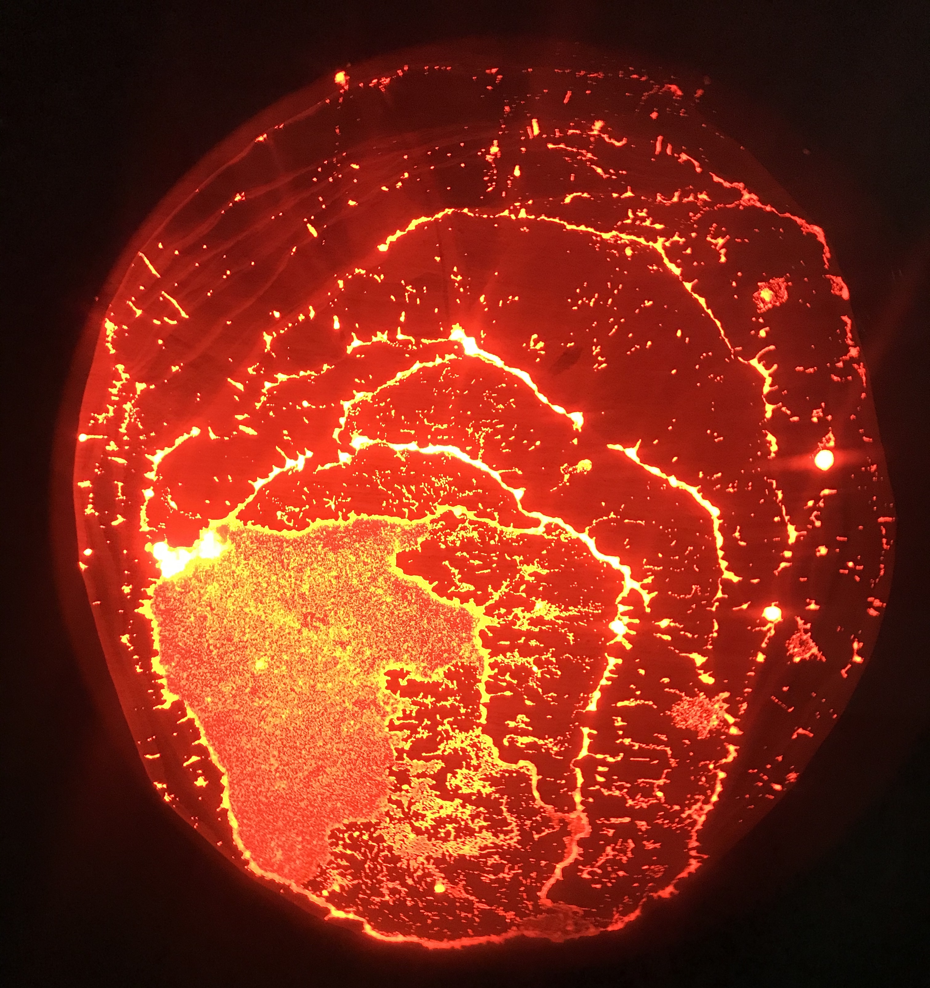 The image illustrates the pattern deposited on a surface after the evaporation of a micro-droplet which contains Rhodamine particles under a microscope. It creates an illusion of a Red Giant in a telescope upon first sight. The mysterious beauty of science emerges when people realize what they saw.