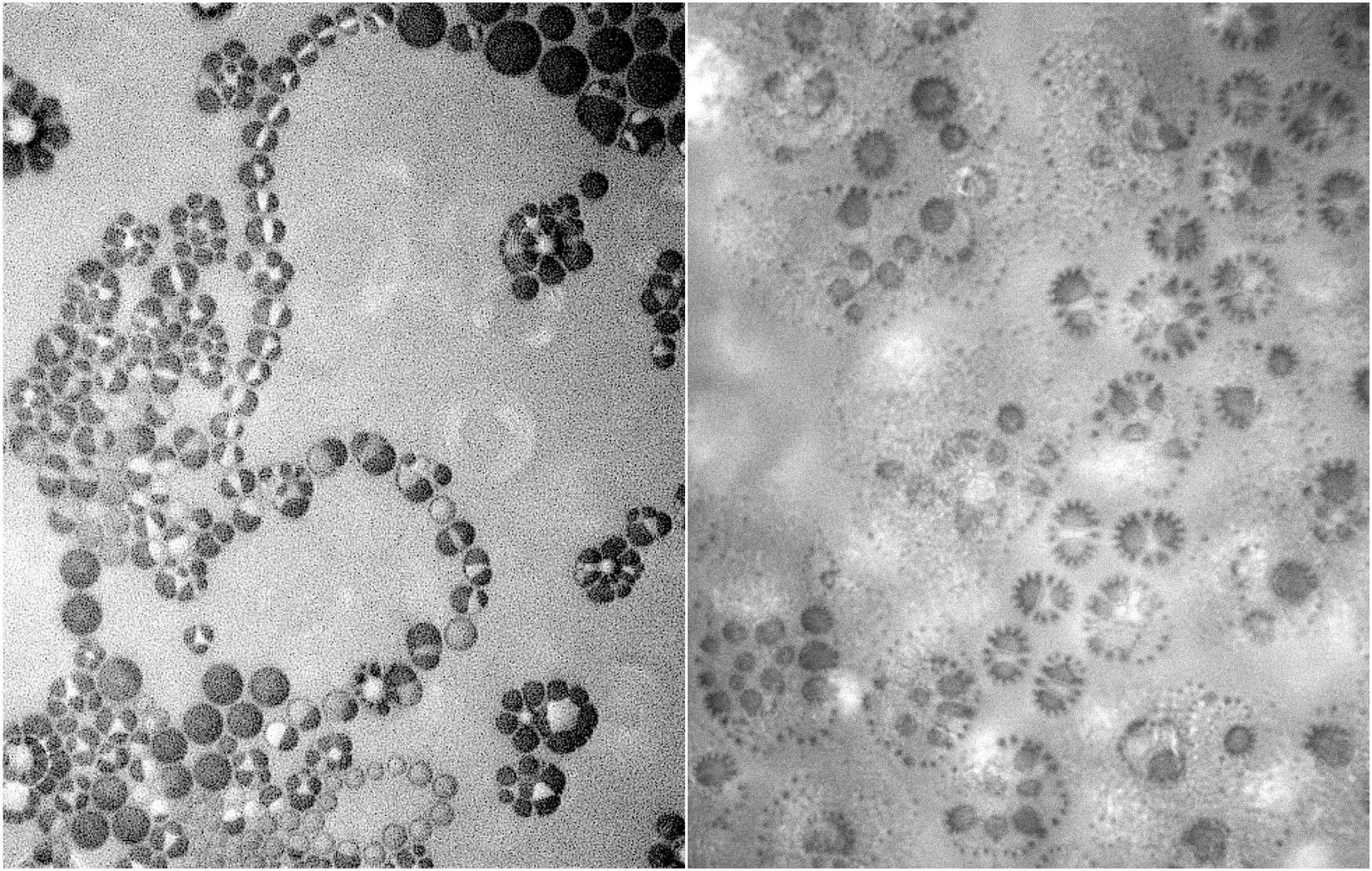 Anionic surfactant, Sodium Linear Alkylbenzene Sulfonate (NaLAS), forms flow-shape, pill-shape and necklace-shape at the liquid-air interface during the cooling process.
