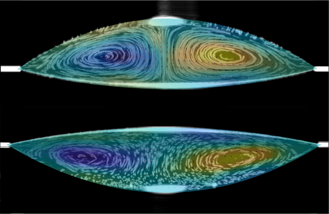 Internal flow pattern during convective stage of evaporation for two binary liquid droplets, showing the effect of gravity on controlling flow direction. Composite image created from time averaged optical coherence tomography measurements over 30 seconds overlaid with the flow pattern map from PIVLab measurements.
